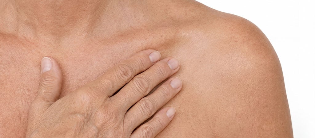 menopausia y piel